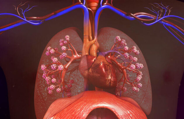 Chest-TB